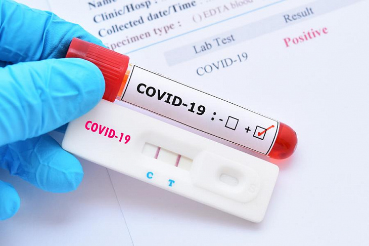 Готова система, выявляющая «британский» штамм COVID-19