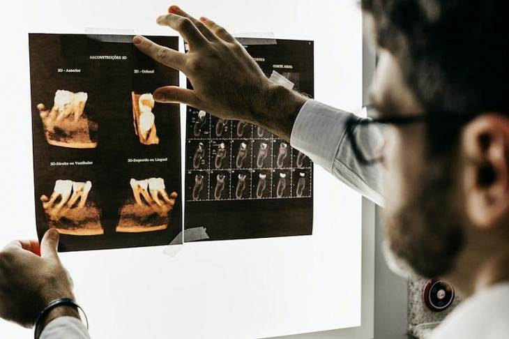 Выявлена смертельная опасность заболеваний десен