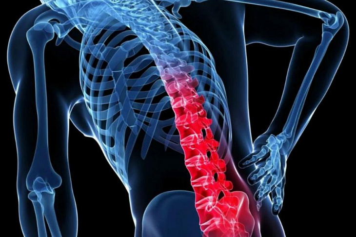 Убирать боль в позвоночнике следует только после выявления причины, говорят медики