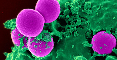 Стволовые клетки полностью восстановили мозг крыс после инсульта