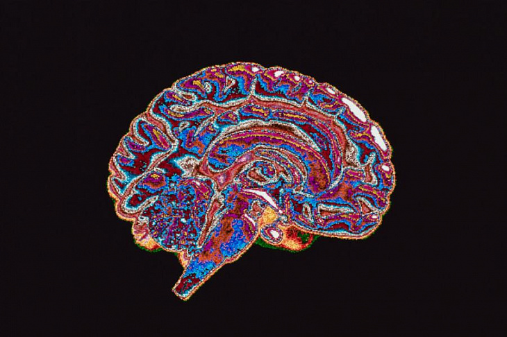 Российские исследователи рассказали, как спасти клетки головного мозга от гибели