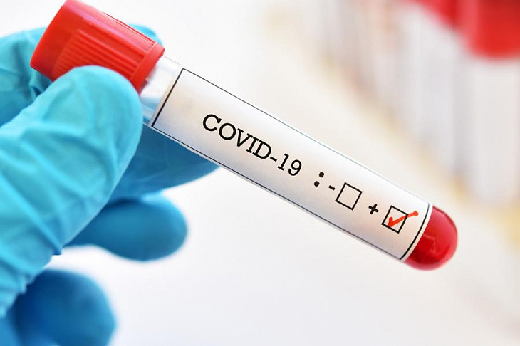 Ученые назвали причину повторного заражения коронавирусом