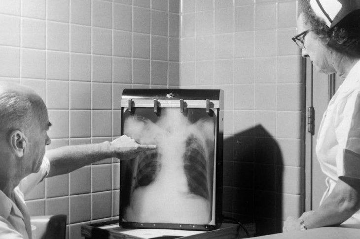 Онколог назвал три главных симптома рака легкого