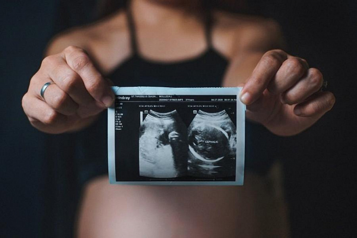 Ковид и беременность: что мы знаем сегодня