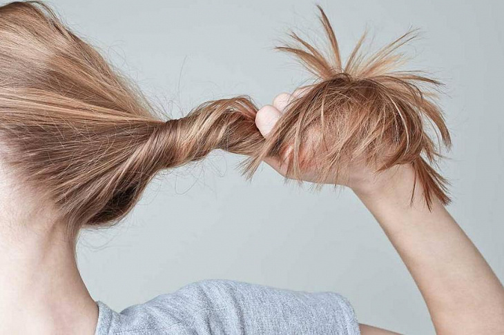 До трех месяцев: врач назвала срок выпадения волос после COVID-19