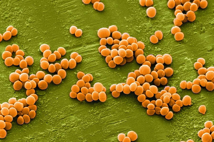 Устойчивый к терапии золотистый стафилококк победили природным лекарством