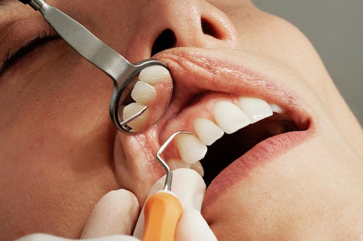 Пародонтит: из-за чего он возникает и как его предотвратить