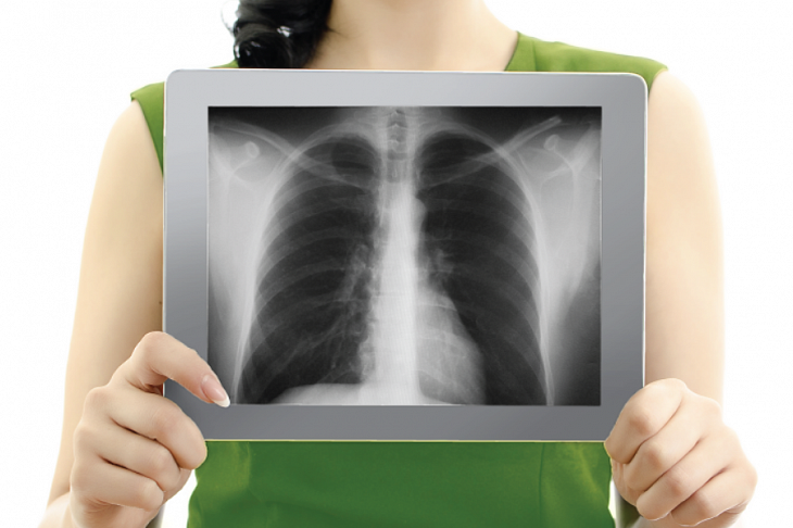 Российская нейросеть упростит выявление пациентов с COVID-19