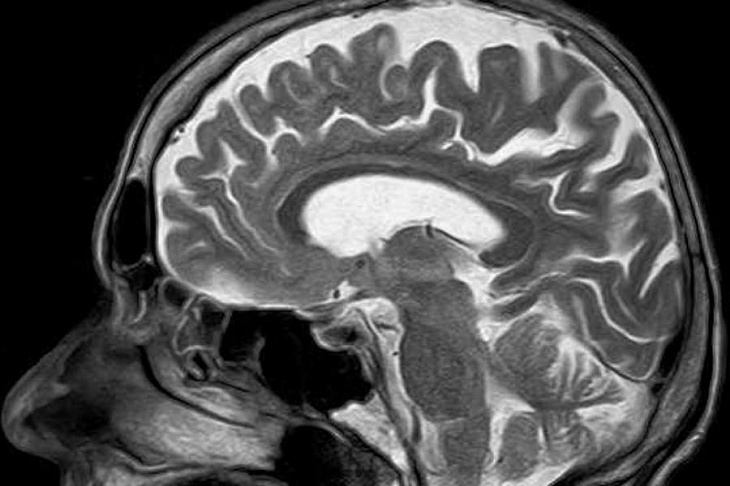 Революция в медицине: инженеры создали портативный МРТ-сканер