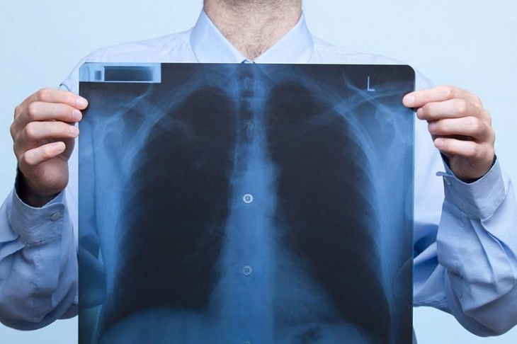 В России создали аппарат жидкостной вентиляции легких