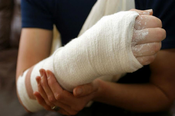 Эксперты пролили свет на возникновение переломов у некоторых людей