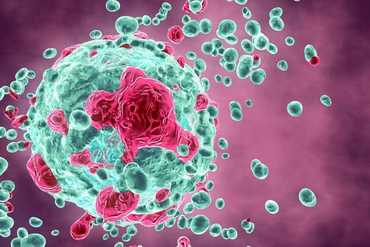 В России начнут использовать продвинутую технологию лечения рака